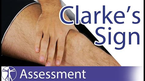 clarke's test patellofemoral pain syndrome